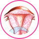 colposcopy