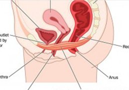 Cystocele Prolapse