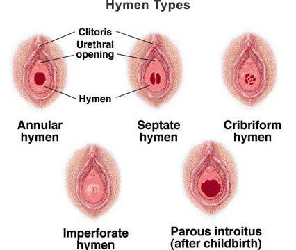 Adult Hymen 14