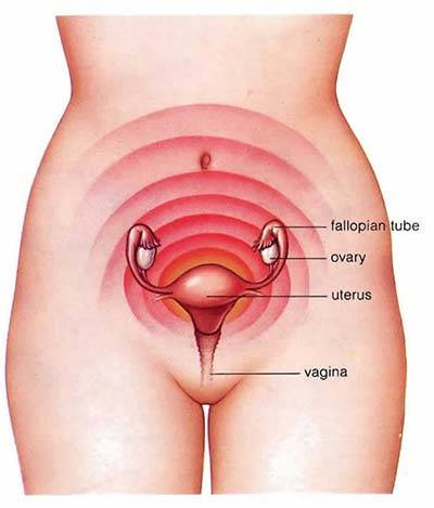Menstrual Cramps | NYC Dysmenorrhea Specialist